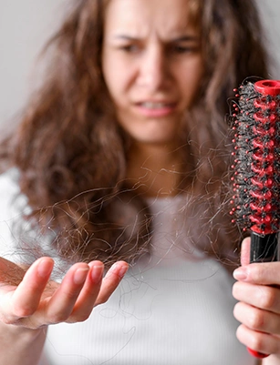 PCOS hair loss treatment
